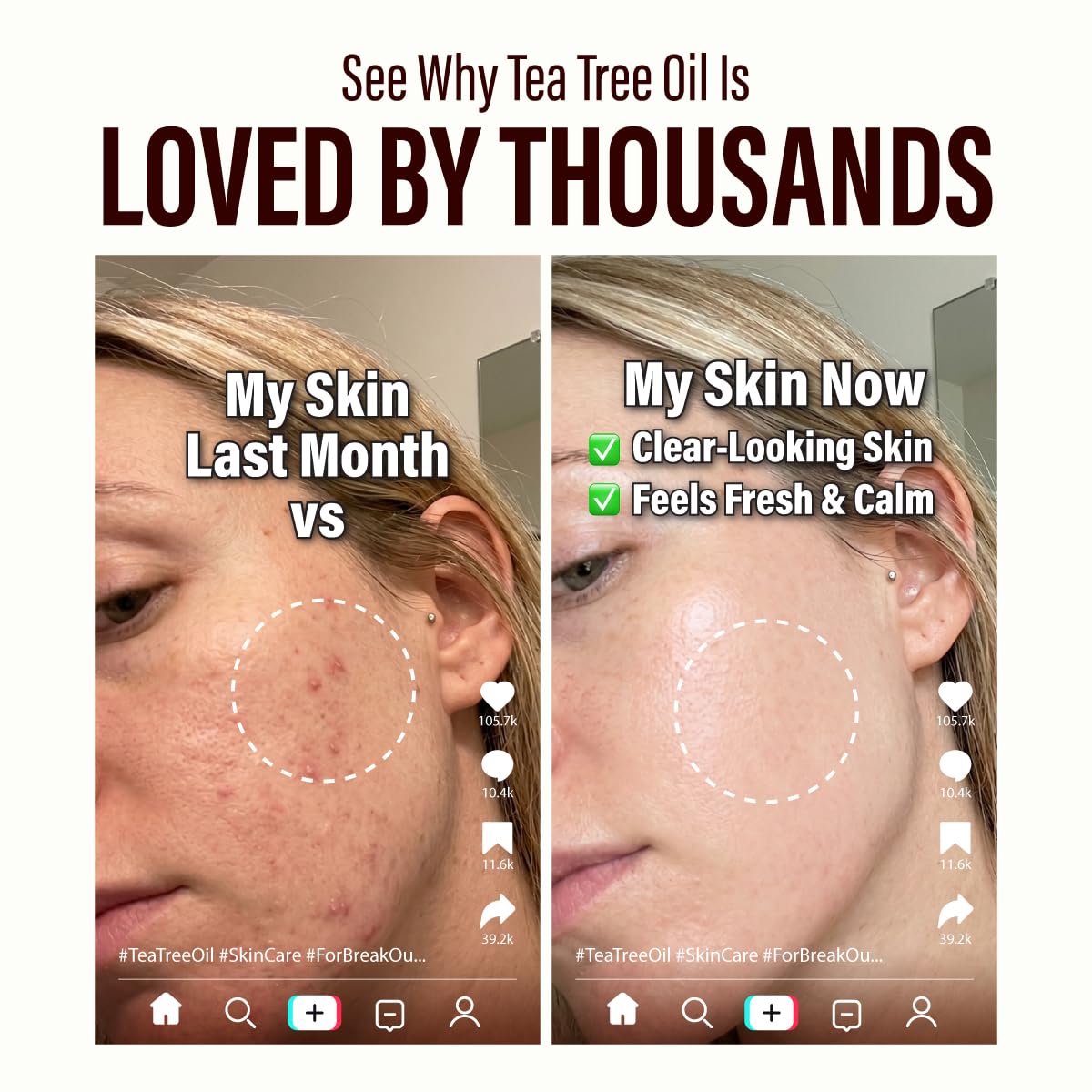 Tea Tree Essential Oil with Aromatherapy Stone - Image 7