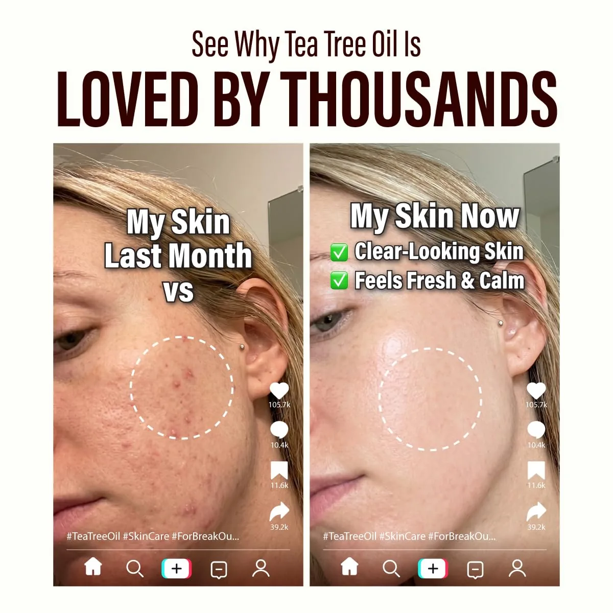 Tea Tree Essential Oil with Aromatherapy stone - Image 7